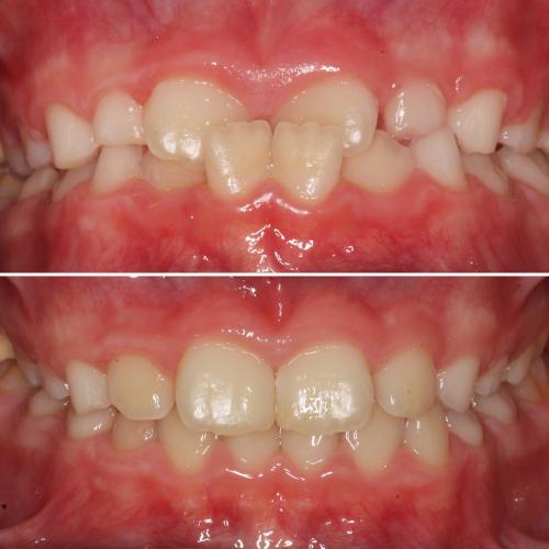 Ortodontia e Odontopediatria - Drª Joana Soares